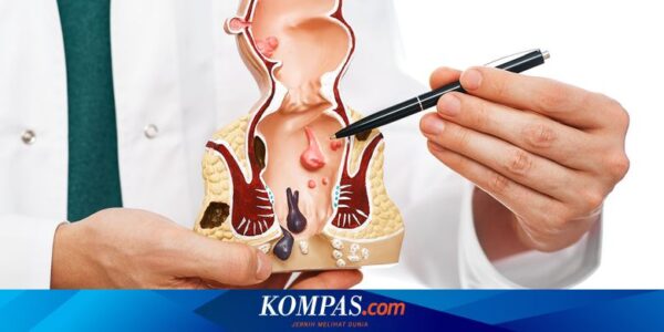 5 Cara Alami Menghilangkan Ambeien Tanpa Obat dan Operasi