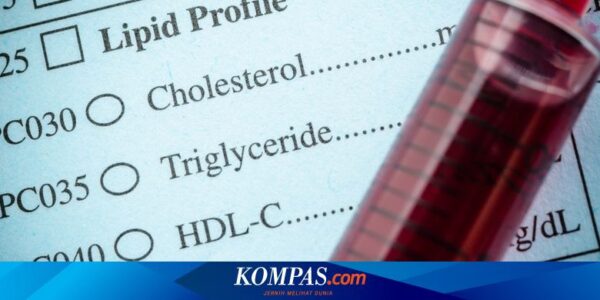 18 Penyebab Kolesterol Tinggi pada Wanita, Termasuk Stres
