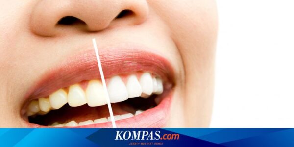 Bagaimana Cara Menjadikan Gigi Lebih Putih?