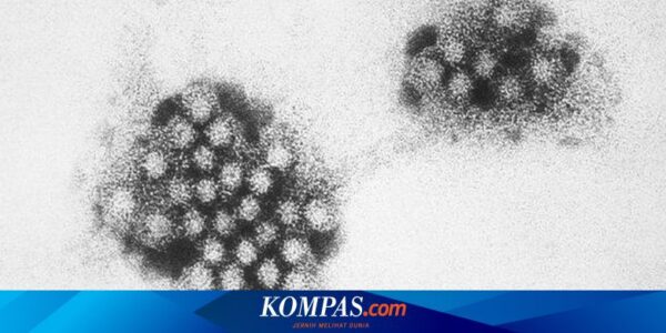 Kenali Apa Itu Norovirus, yang Bisa Menyebar Melalui Makanan