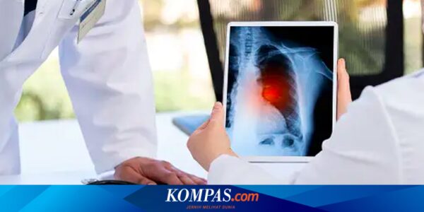 Apa saja Pengobatan Kanker Paru-paru? Berikut Penjelasan Dokter…