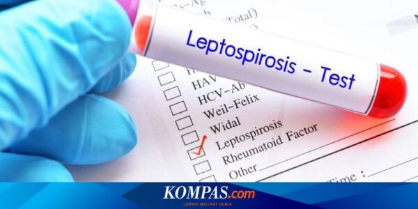 Gejala Leptospirosis Apa Saja? Berikut 9 Daftarnya