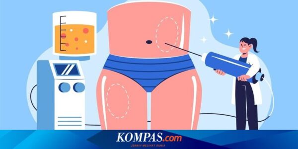 Sedot Lemak Aman Asal Dilakukan oleh Dokter yang Kompeten