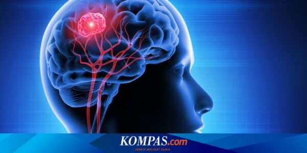 Obat Antidepresi Berpotensi Atasi Tumor Otak