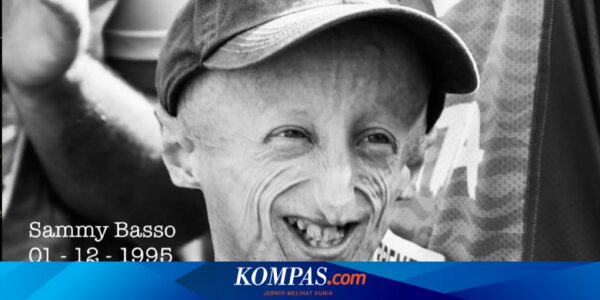 Apa Penyebab Penyakit Progeria? Berikut Penjelasannya…