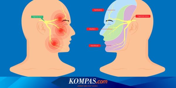 Sering Nyeri di Wajah? Waspadai Neuralgia Trigeminal, Ini Kata Dokter