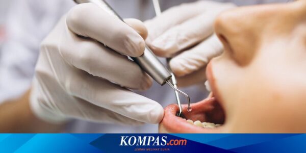 Solusi Atasi Gigi Berlubang, dari Penambalan hingga Perawatan Fluoride